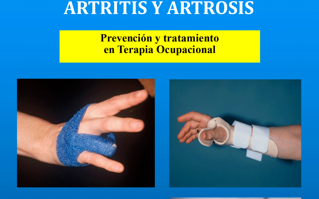 Reseña libro: Rehabilitación funcional de las manos con artritis y artrosis